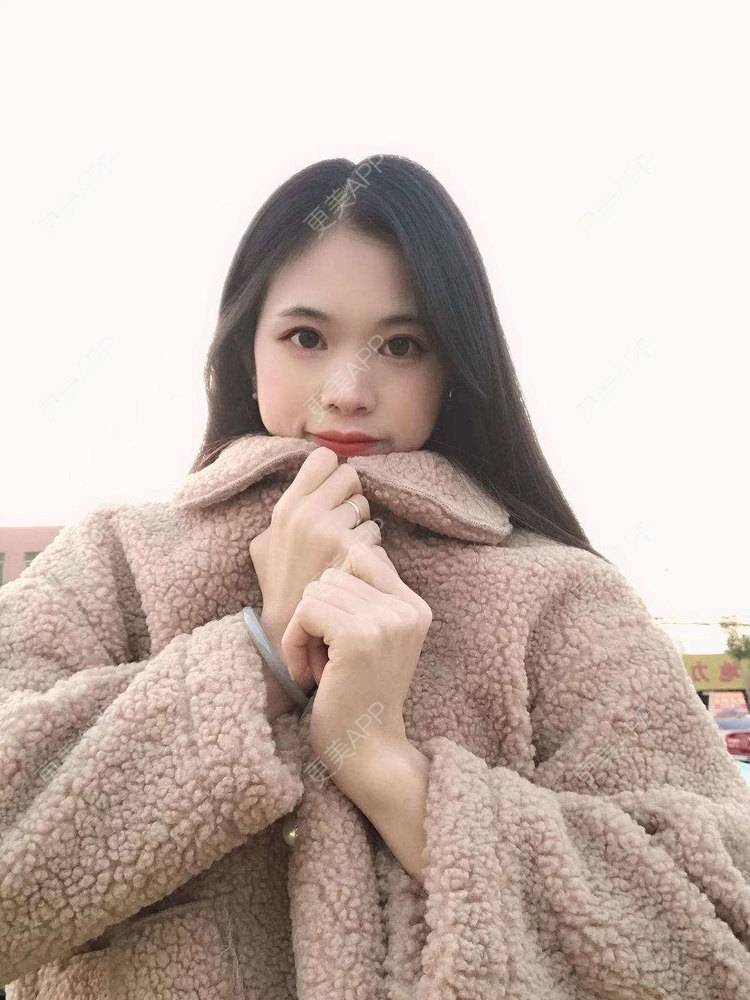 更美 - 更美^_^的眼部多项经验 | 眼部多项 | 广州