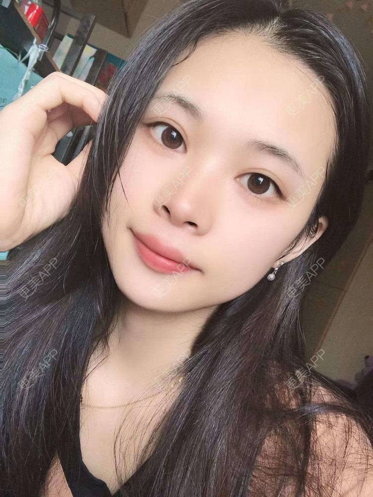 更美 - 更美^_^的眼部多项经验 | 眼部多项 | 广州