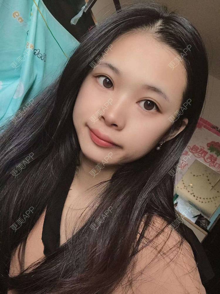 更美 - 更美^_^的眼部多项经验 | 眼部多项 | 广州