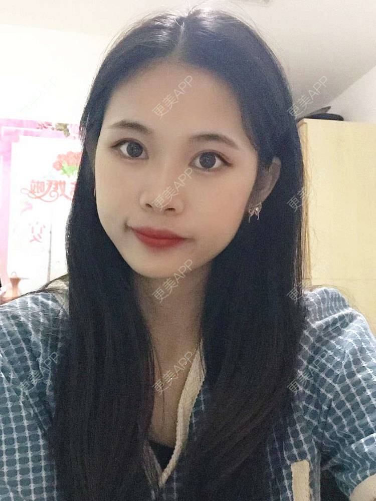 更美 - 更美^_^的眼部多项经验 | 眼部多项 | 广州