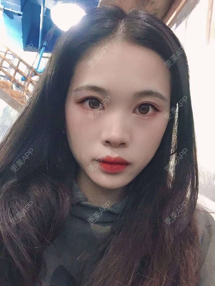 更美 - 更美^_^的眼部多项经验 | 眼部多项 | 广州