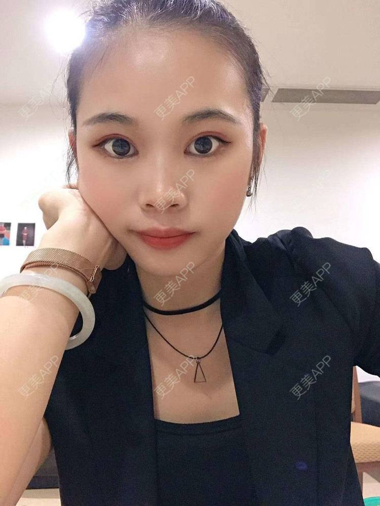 更美 - 更美^_^的眼部多项经验 | 眼部多项 | 广州