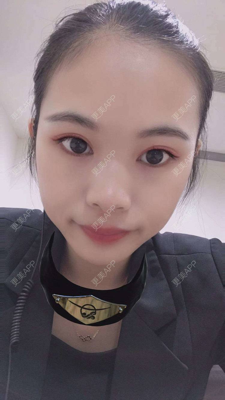 更美 - 更美^_^的眼部多项经验 | 眼部多项 | 广州