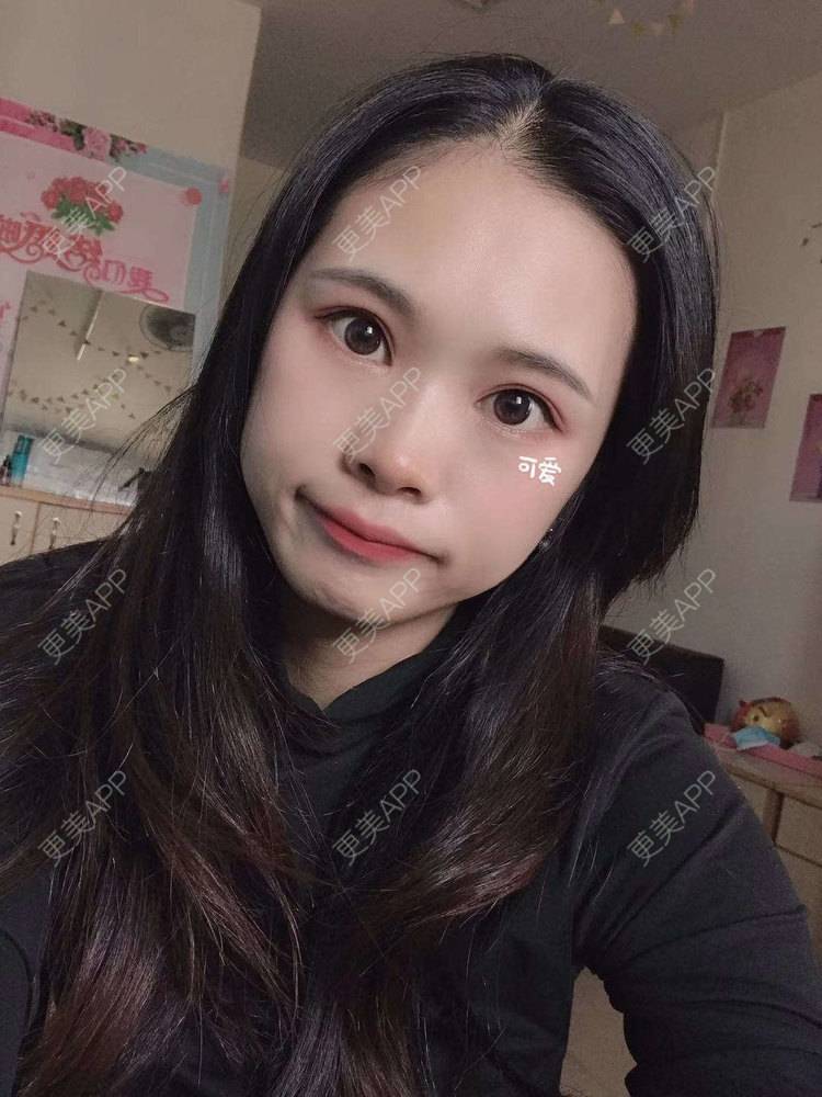 更美 - 更美^_^的眼部多项经验 | 眼部多项 | 广州