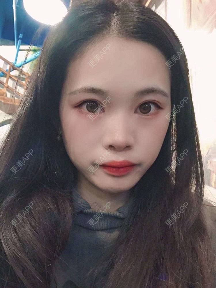 更美 - 更美^_^的眼部多项经验 | 眼部多项 | 广州