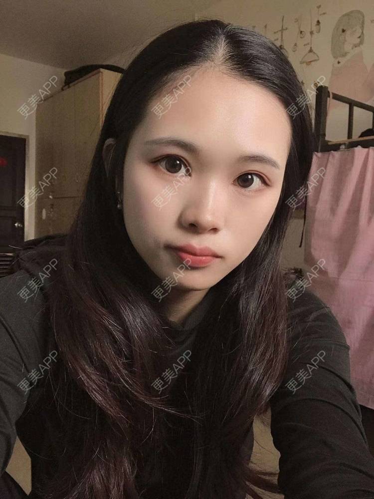 更美 - 更美^_^的眼部多项经验 | 眼部多项 | 广州