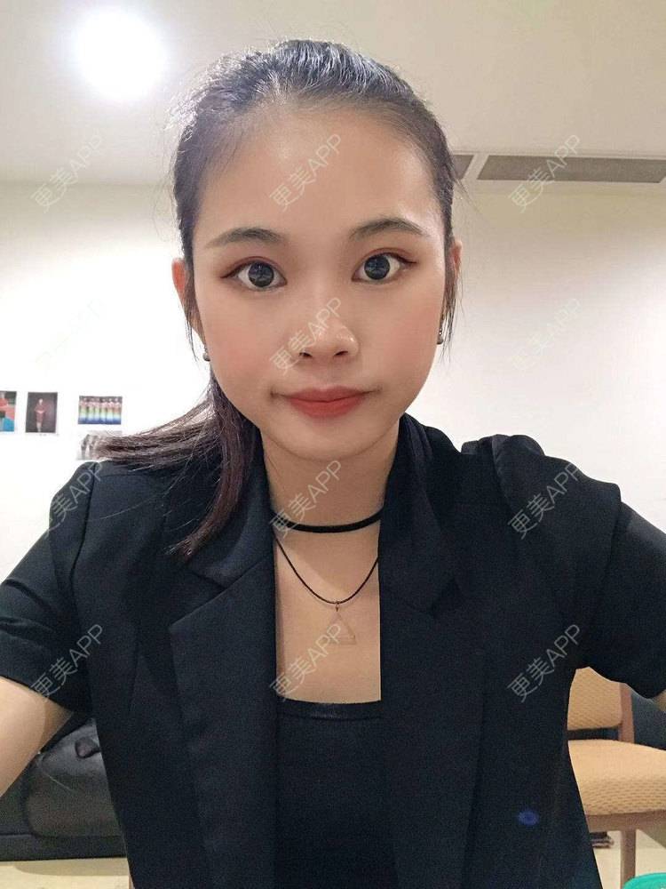 更美 - 更美^_^的眼部多项经验 | 眼部多项 | 广州