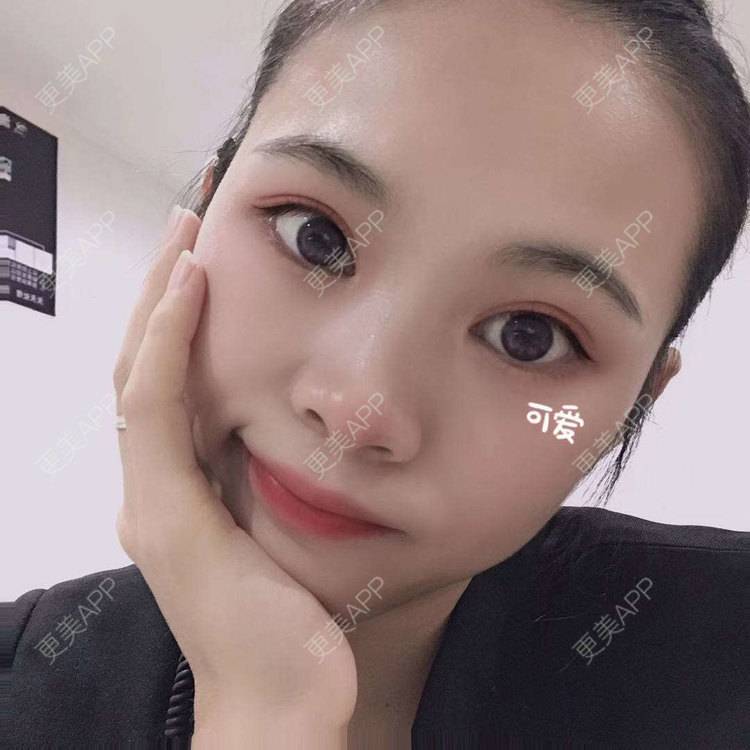 更美 - 更美^_^的眼部多项经验 | 眼部多项 | 广州