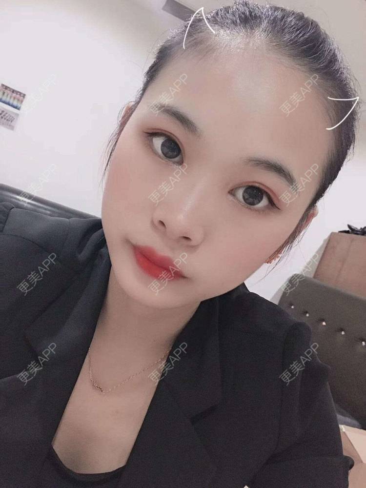 更美 - 更美^_^的眼部多项经验 | 眼部多项 | 广州