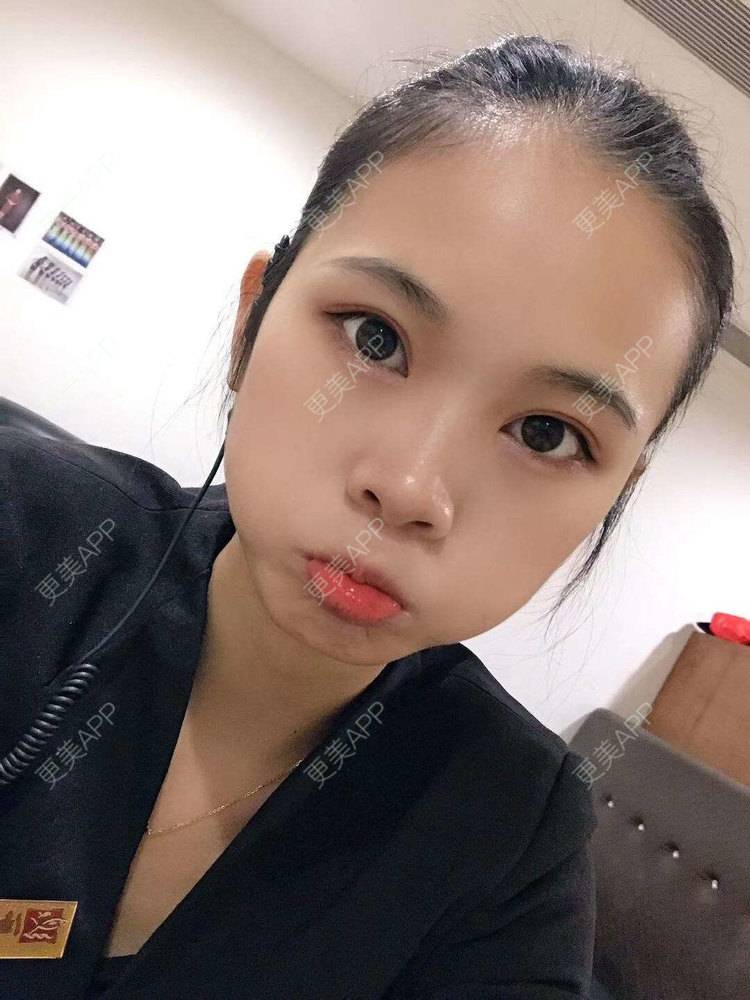 更美 - 更美^_^的眼部多项经验 | 眼部多项 | 广州