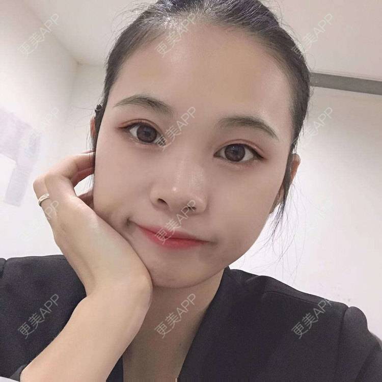 更美 - 更美^_^的眼部多项经验 | 眼部多项 | 广州