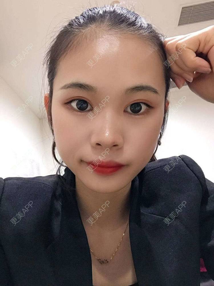 更美 - 更美^_^的眼部多项经验 | 眼部多项 | 广州