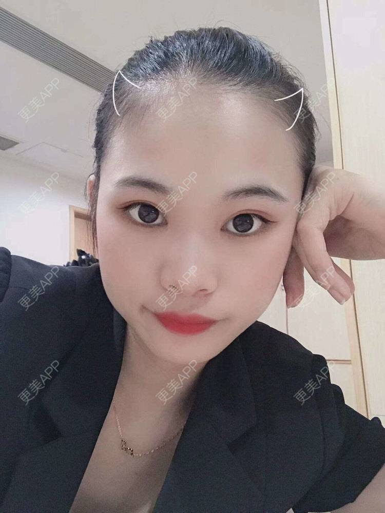 更美 - 更美^_^的眼部多项经验 | 眼部多项 | 广州