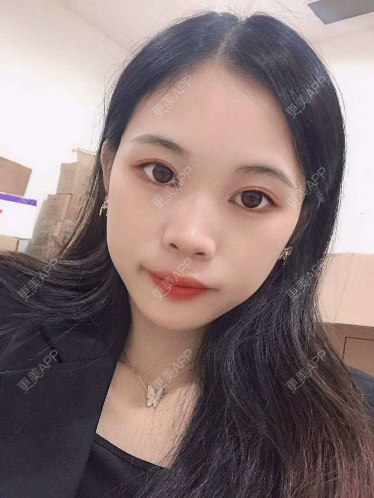 更美 - 更美^_^的眼部多项经验 | 眼部多项 | 广州