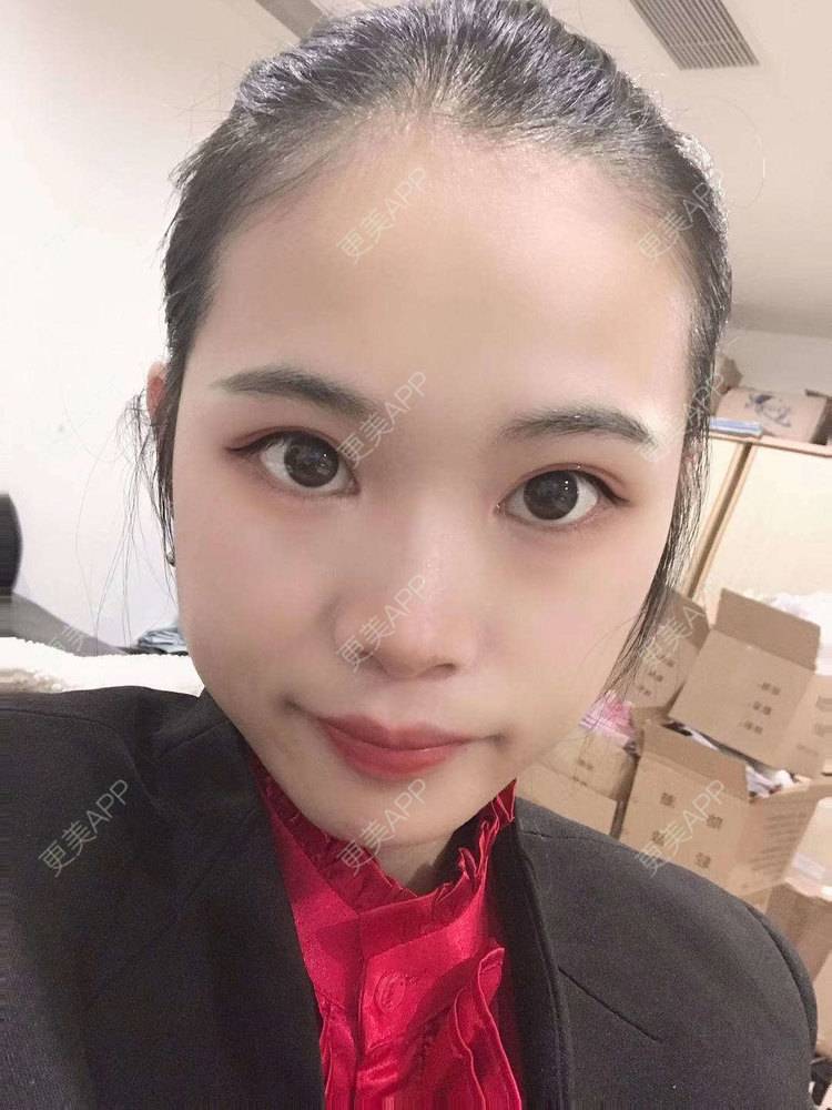 更美 - 更美^_^的眼部多项经验 | 眼部多项 | 广州