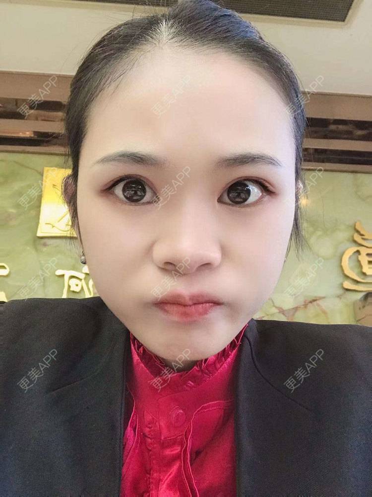 更美 - 更美^_^的眼部多项经验 | 眼部多项 | 广州