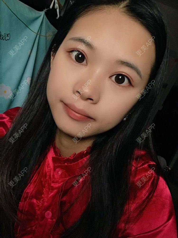 更美 - 更美^_^的眼部多项经验 | 眼部多项 | 广州