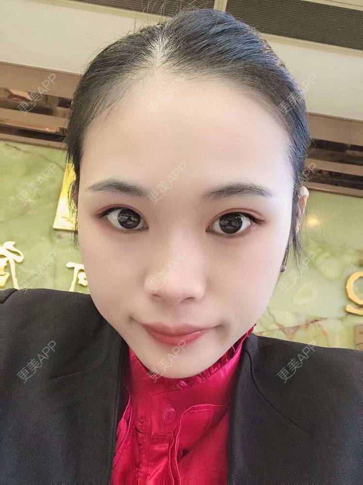 更美 - 更美^_^的眼部多项经验 | 眼部多项 | 广州