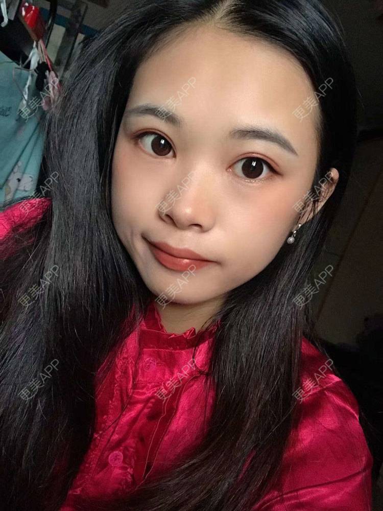 更美 - 更美^_^的眼部多项经验 | 眼部多项 | 广州