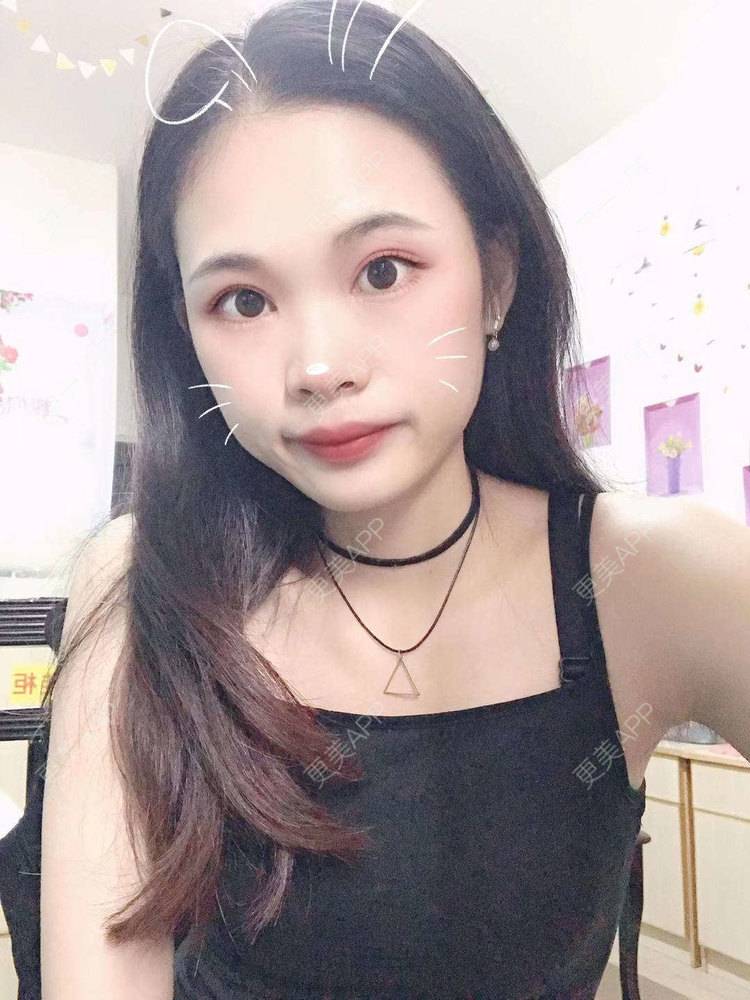 更美 - 更美^_^的眼部多项经验 | 眼部多项 | 广州