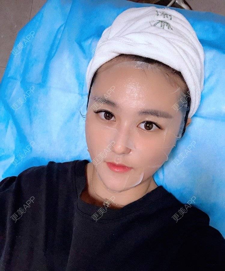 更美 - 更美用户3UXoCNtWel的光纤溶脂经验 | 北京 | 光纤溶脂