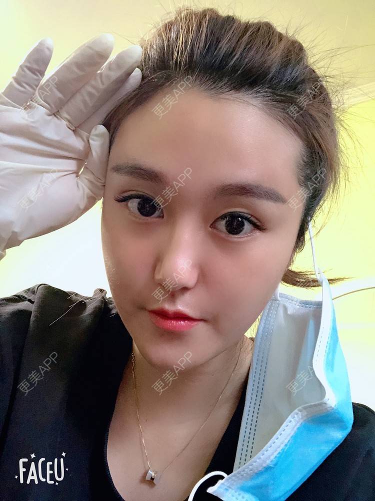 更美 - 更美用户3UXoCNtWel的光纤溶脂经验 | 北京 | 光纤溶脂