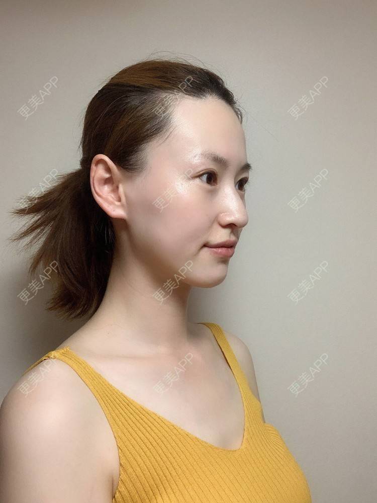 更美 - 释迦果我的爱的水氧活肤经验 | 水氧活肤
