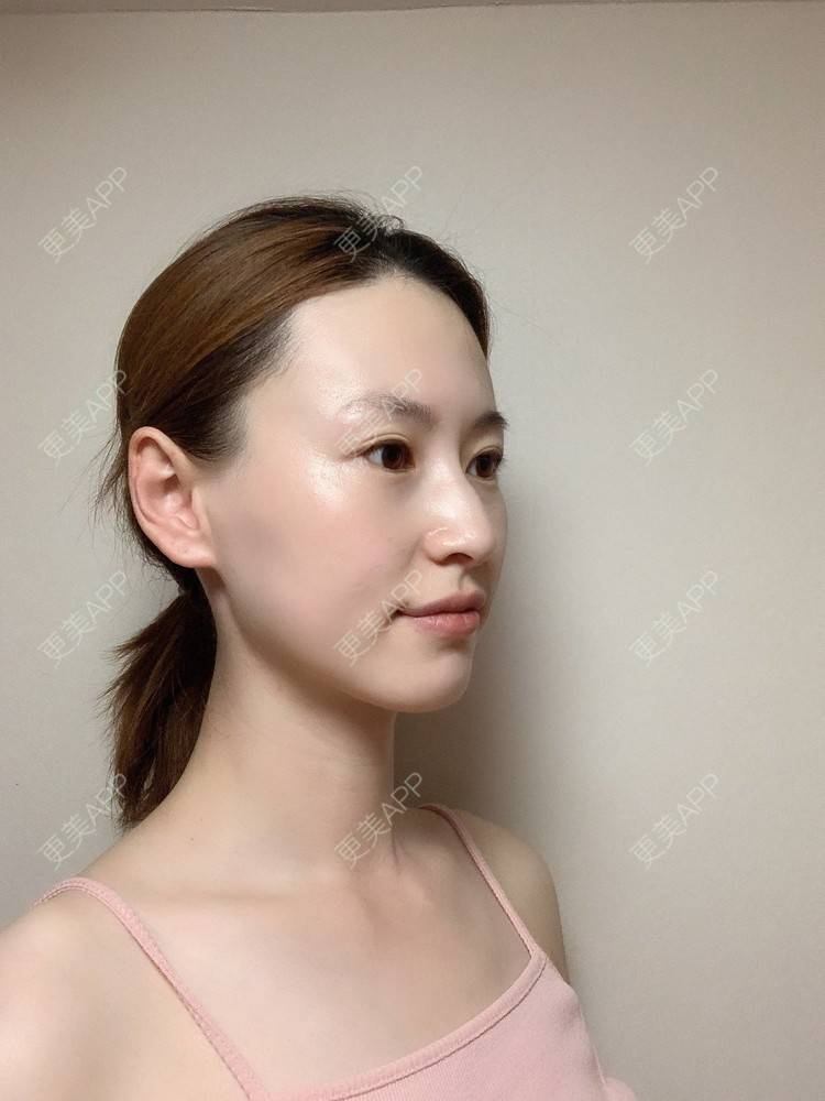 更美 - 释迦果我的爱的水氧活肤经验 | 水氧活肤