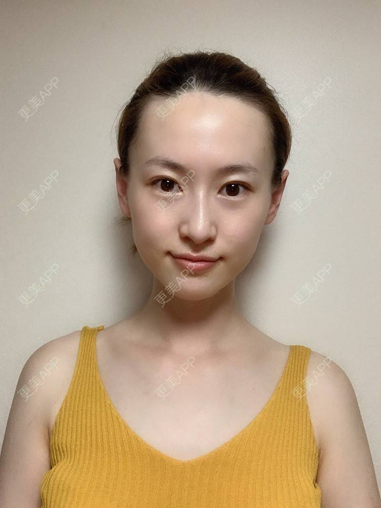 更美 - 释迦果我的爱的水氧活肤经验 | 水氧活肤