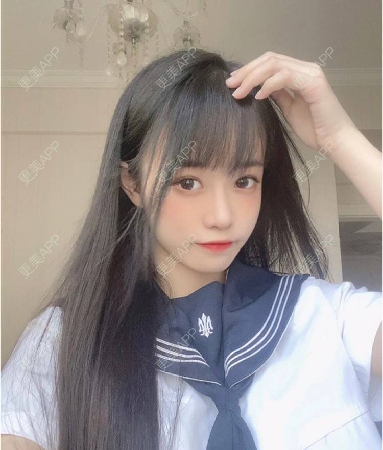 更美 - 更美用户jIHznB4J6a的玻尿酸苹果肌经验 | 杭州 | 玻尿酸苹果肌 | 玻尿酸全面部