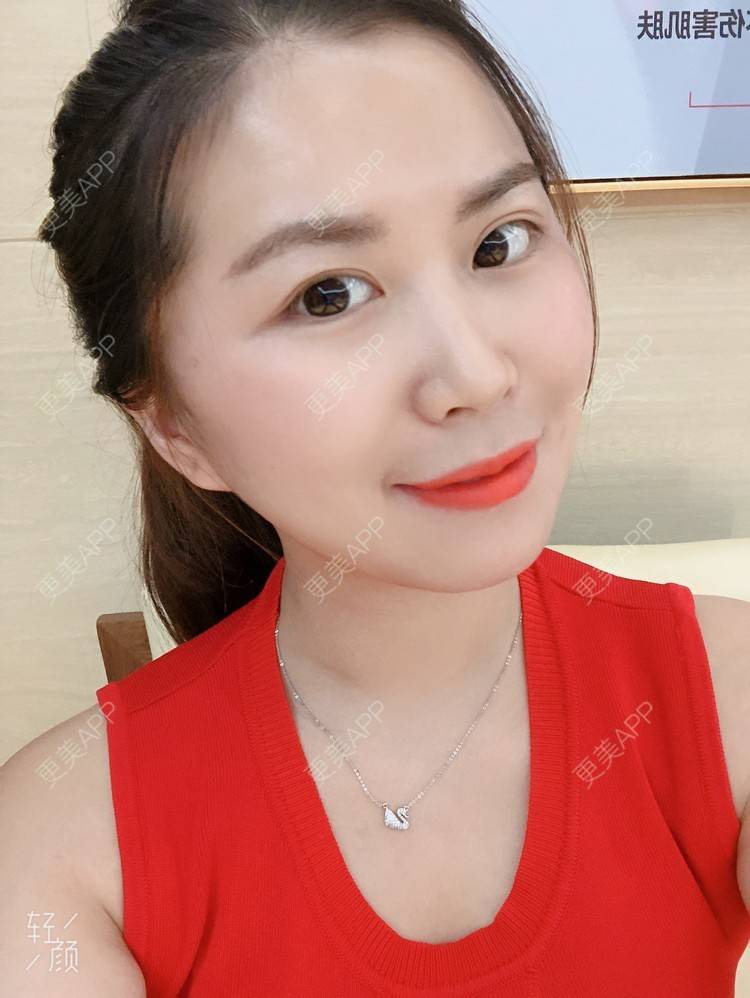 更美 - 更美用户wUmw8hIQ2a的拉皮经验 | 郑州 | 拉皮