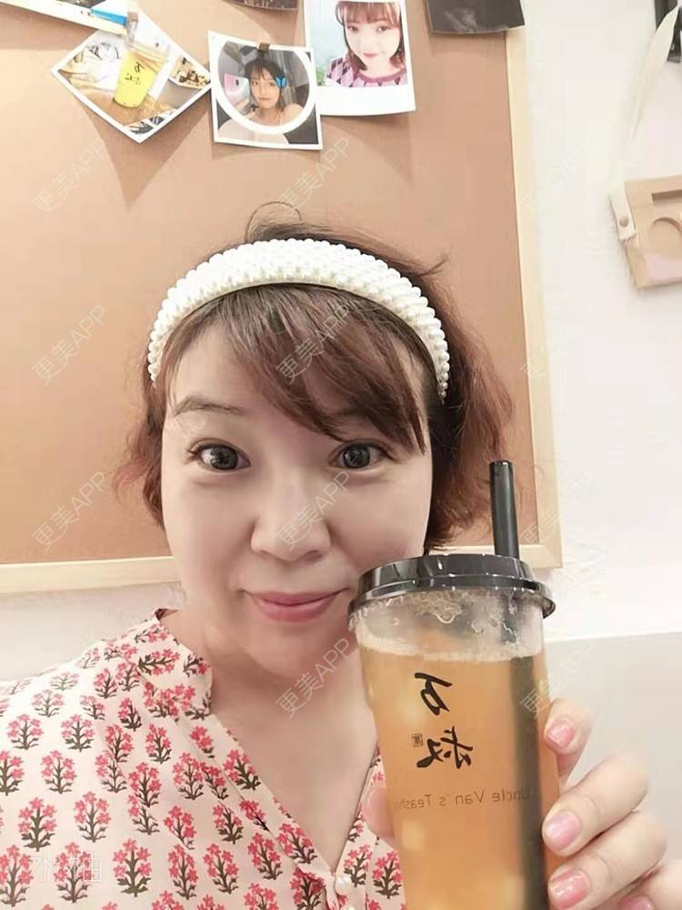 更美 - 笑看人生每天的内切去眼袋经验 | 北京 | 射频去眼袋 | 内切去眼袋 | 外切去眼袋 | 激光去眼袋 | 埋线去眼袋