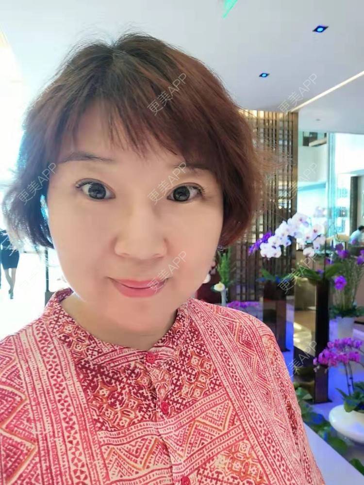 更美 - 笑看人生每天的内切去眼袋经验 | 北京 | 射频去眼袋 | 内切去眼袋 | 外切去眼袋 | 激光去眼袋 | 埋线去眼袋