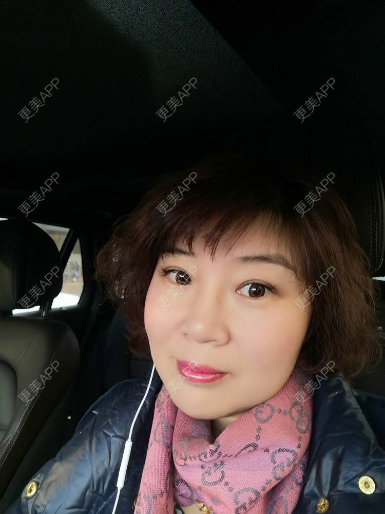 更美 - 笑看人生每天的内切去眼袋经验 | 北京 | 射频去眼袋 | 内切去眼袋 | 外切去眼袋 | 激光去眼袋 | 埋线去眼袋