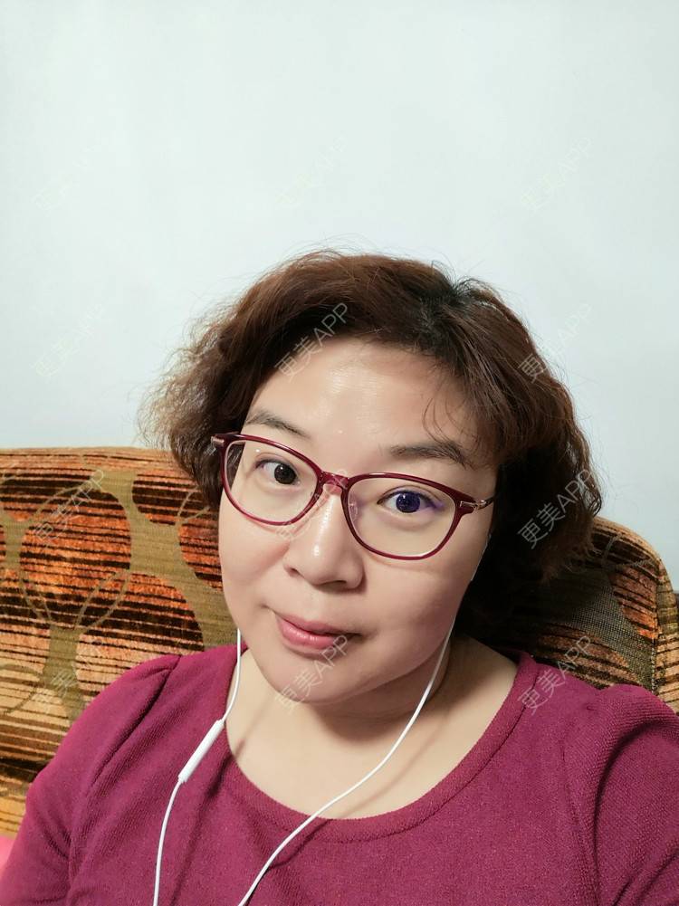 更美 - 笑看人生每天的内切去眼袋经验 | 北京 | 射频去眼袋 | 内切去眼袋 | 外切去眼袋 | 激光去眼袋 | 埋线去眼袋