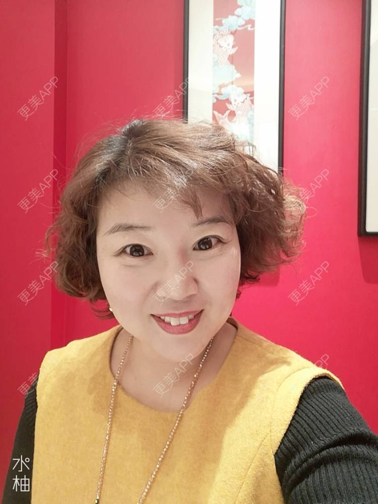 更美 - 笑看人生每天的内切去眼袋经验 | 北京 | 射频去眼袋 | 内切去眼袋 | 外切去眼袋 | 激光去眼袋 | 埋线去眼袋