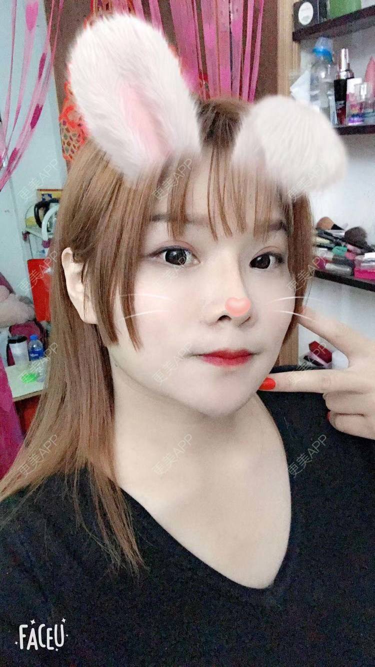 更美 - 小小小迷妹的吸脂瘦脸经验 | 吸脂瘦脸 | 双下巴吸脂 | 深圳