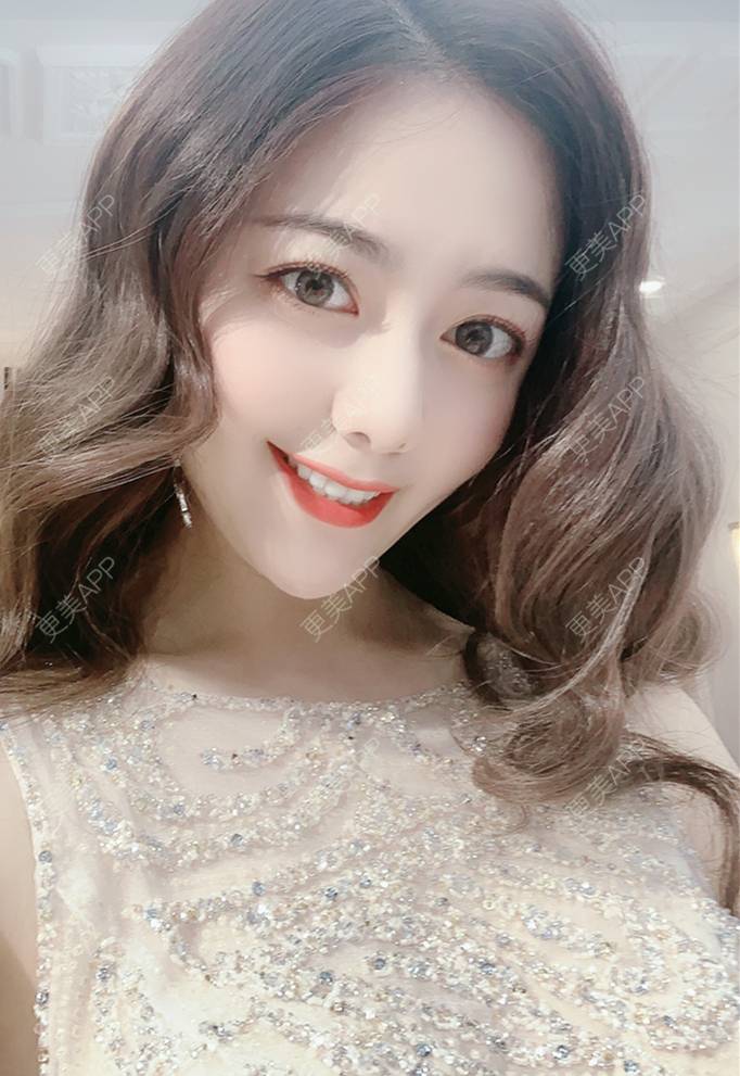 更美 - 更美用户BYkP5oeoj2的红蓝光清痘经验 | 红蓝光清痘