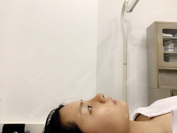 更美 - 肉嘟嘟儿的鼻部多项经验 | 杭州 | 鼻部多项