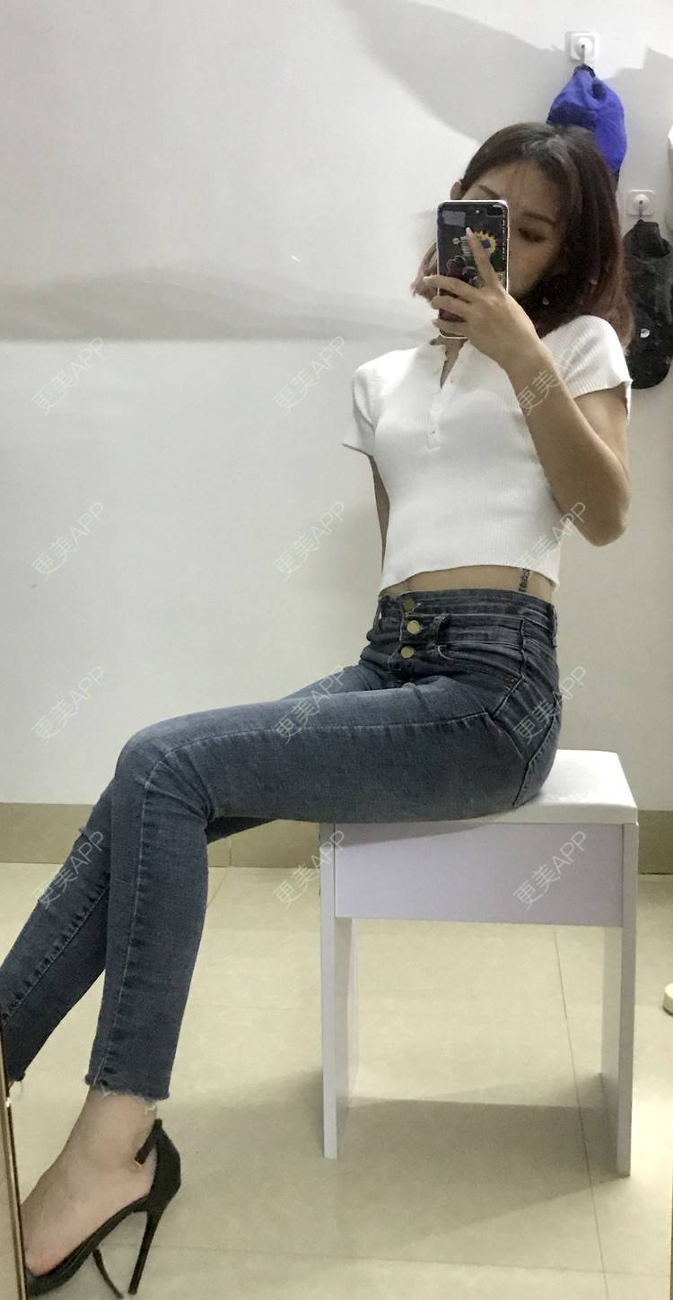 更美 - WHSHHB的腹部吸脂经验 | 腹部吸脂 | 杭州 | 腰部吸脂