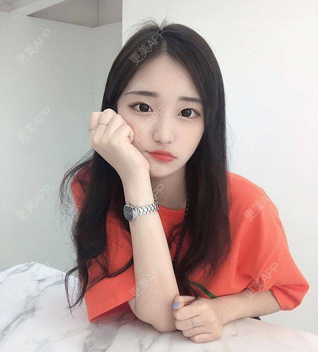 更美 - 更美用户C93SI0ZqND的眼睑下至经验 | 眼睑下至 | 上海