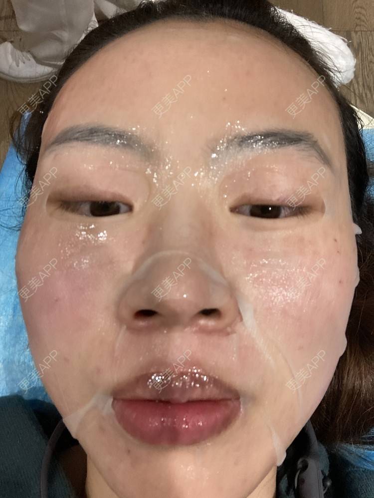 更美 - 更美用户CCLYSpsRdQ的补水套餐经验 | 上海 | 补水套餐