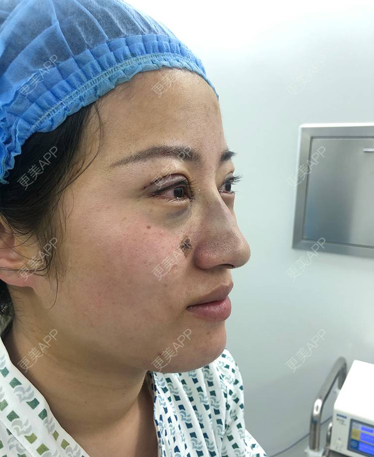 更美 - 泛舟湖心荷塘前。祭的眼部多项经验 | 北京 | 眼部多项