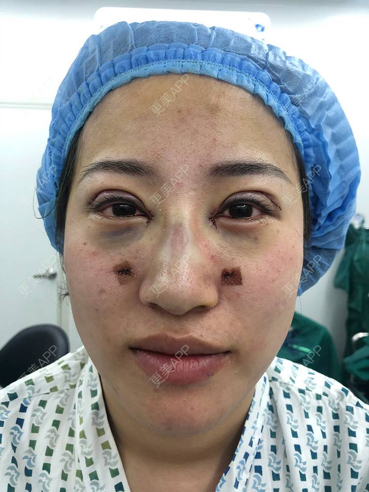 更美 - 泛舟湖心荷塘前。祭的眼部多项经验 | 北京 | 眼部多项