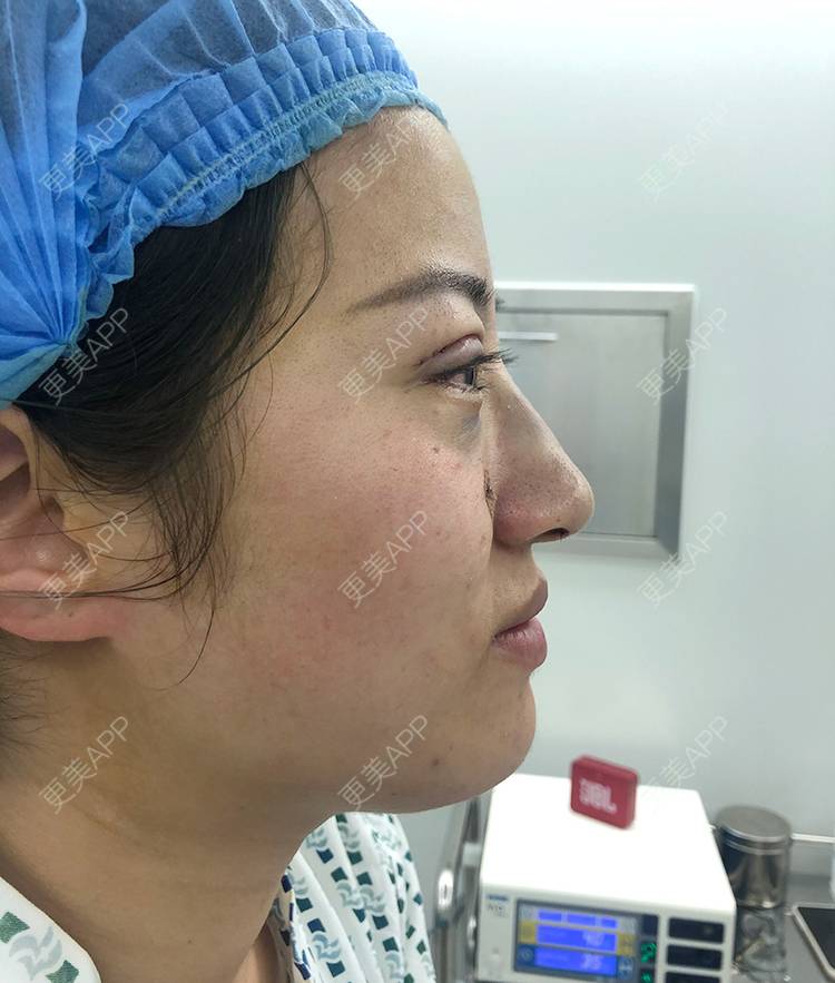 更美 - 泛舟湖心荷塘前。祭的眼部多项经验 | 北京 | 眼部多项