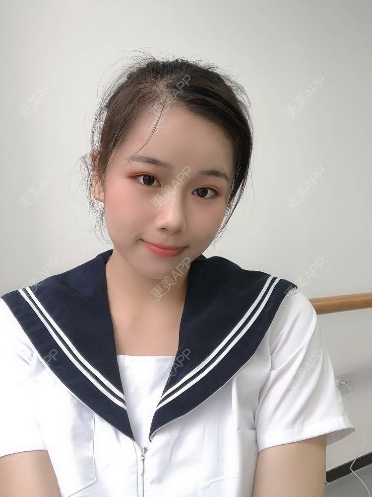 更美 - 更美用户YNJiOl0I4N的全脸整形套餐经验 | 郑州 | 全脸整形套餐