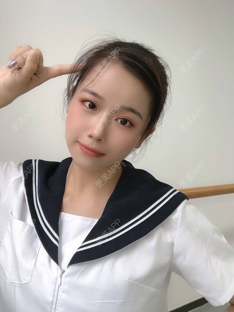 更美 - 更美用户YNJiOl0I4N的全脸整形套餐经验 | 郑州 | 全脸整形套餐