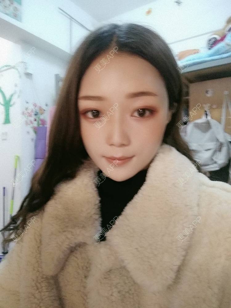 更美 - 芳芳muni的全脸整形套餐经验 | 全脸整形套餐 | 武汉