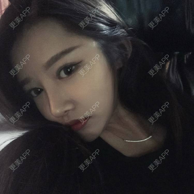 更美 - 🏥AZZX7777的隆鼻经验 | 隆鼻 | 肋软骨隆鼻 | 合肥