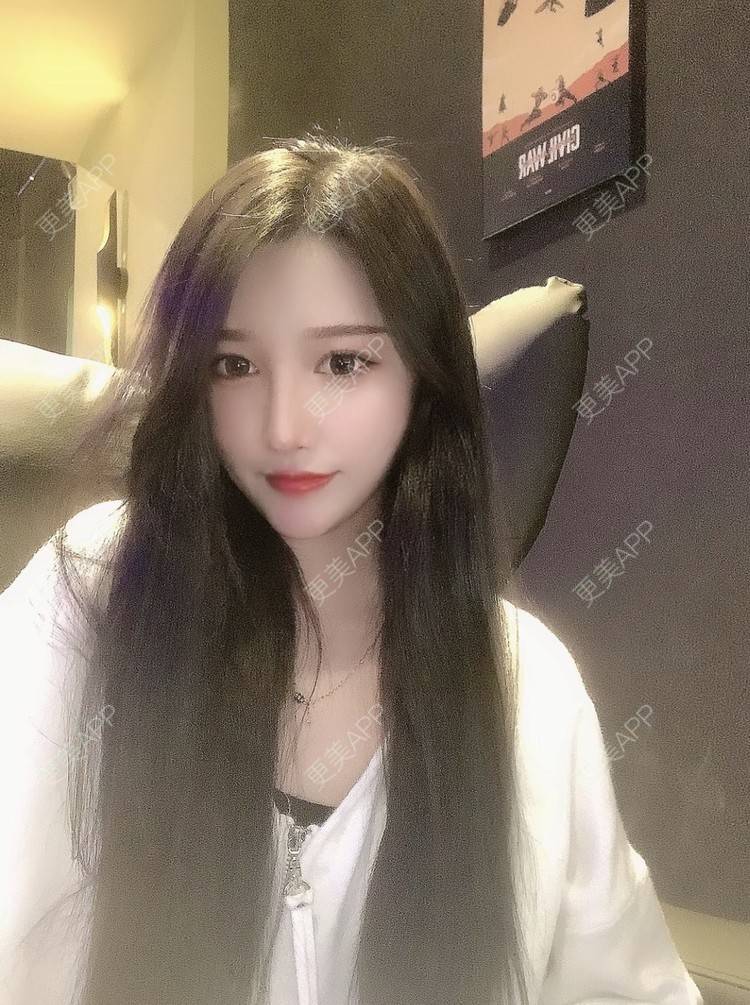 更美 - 🏥AZZX7777的隆鼻经验 | 隆鼻 | 肋软骨隆鼻 | 合肥